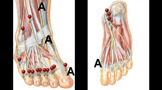 Pain in half the Big Toe by Dr Steven J Dolgoff